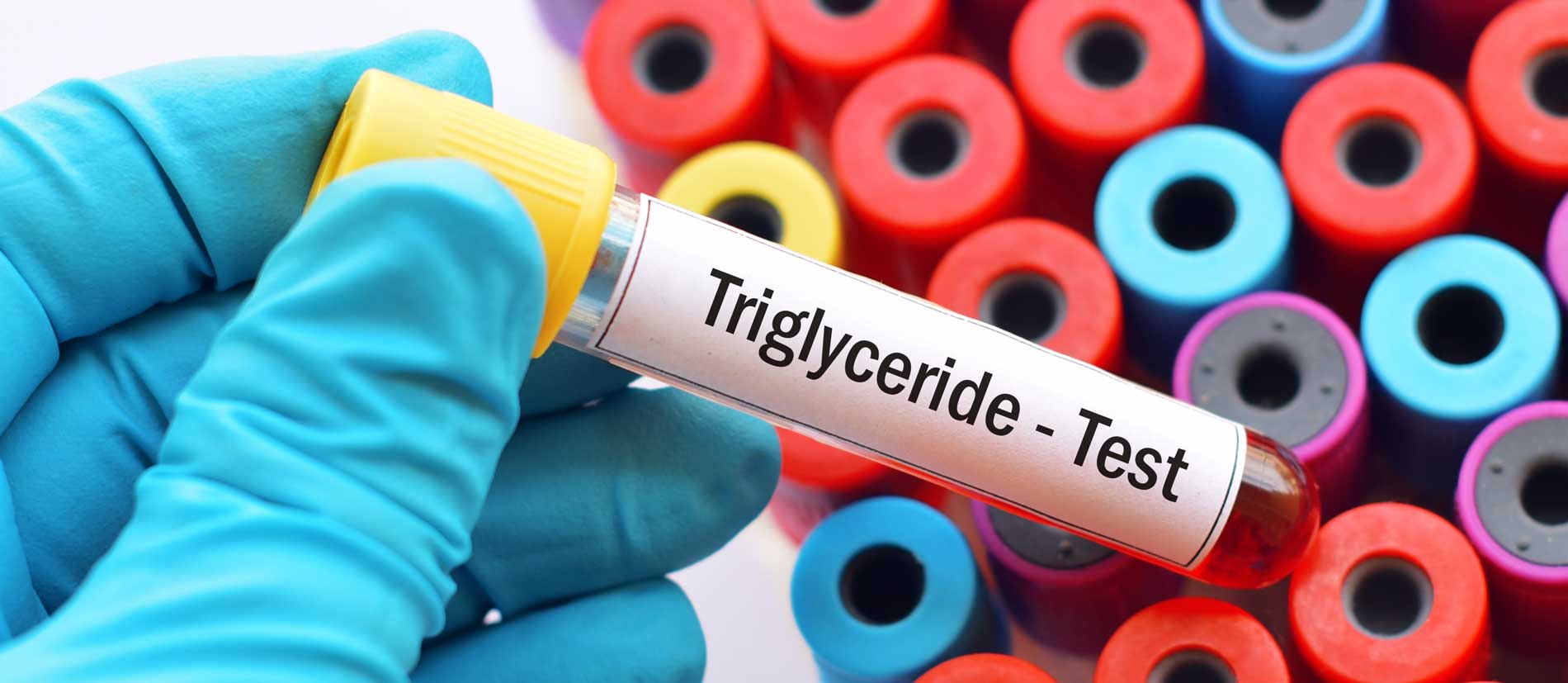 Triglyceride 