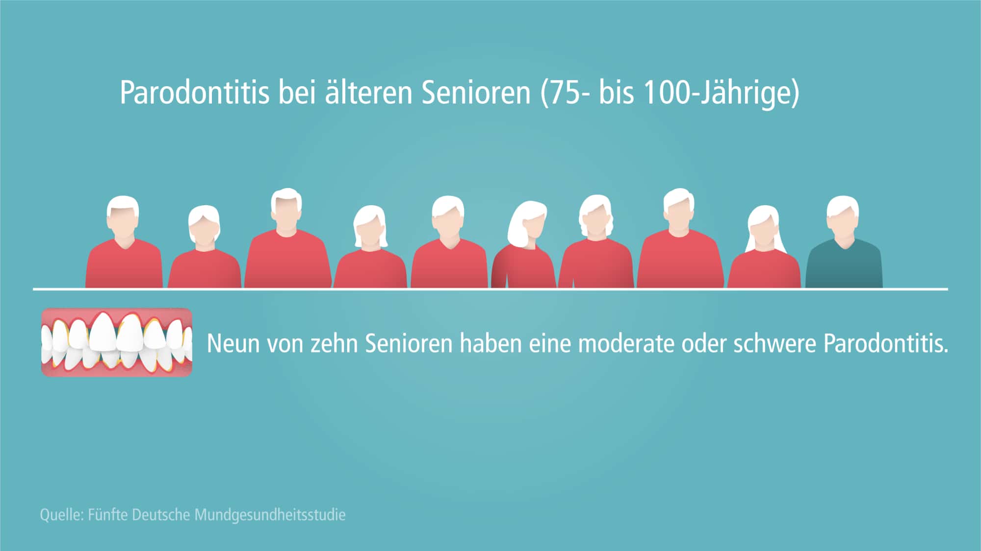 Parodontitisprävalenz bei älteren Senioren 